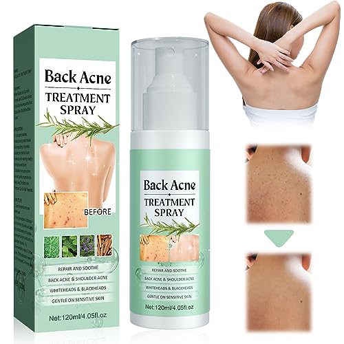 Back Acne Spray, Acne Espalda, Crema Acne Pecho y Espalda, Limpieza Profunda para Una Piel Más Suave, 120 ml