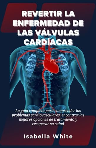 Revertir la Enfermedad de las Válvulas Cardíacas: La guía completa para comprender los problemas cardiovasculares, encontrar las mejores opciones de tratamiento y recuperar su salud